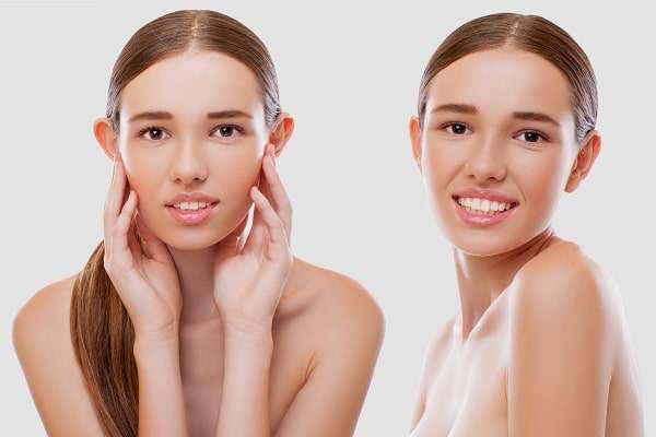 rimedi per orecchie a sventola