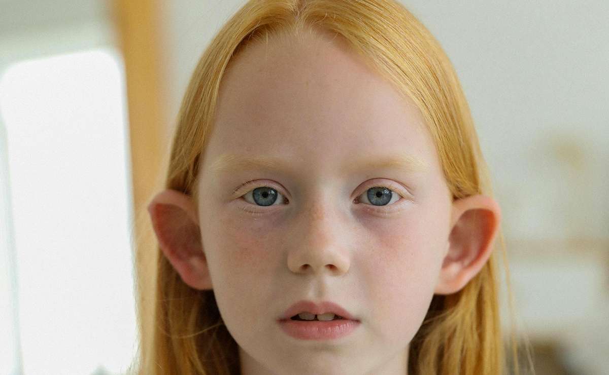 rimedi per orecchie a sventola